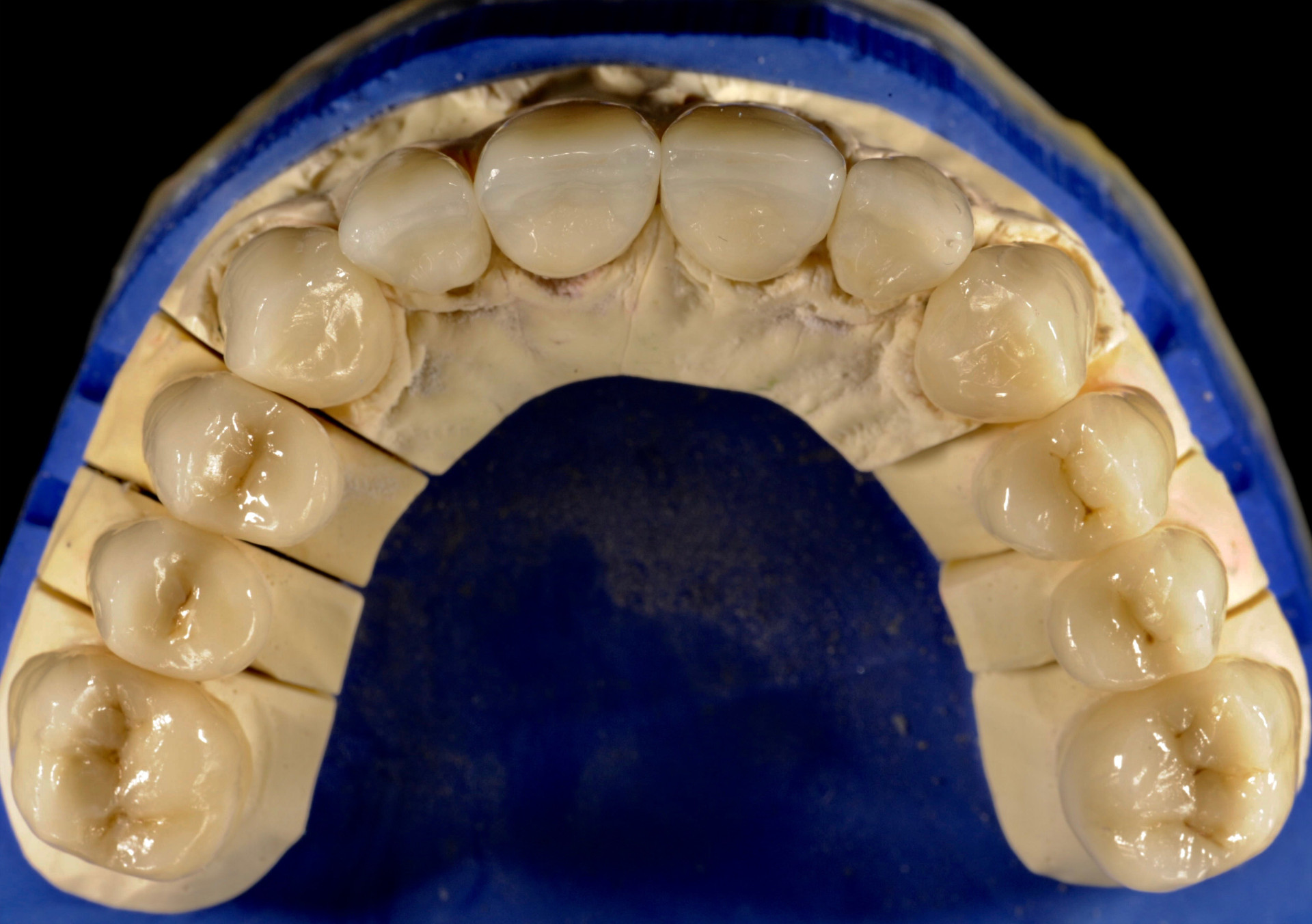 rekonstrukcje zębów